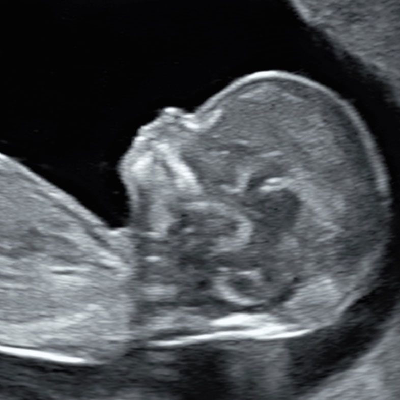 Scan Upon Request - please contact NHS if you think you are in a serious condition