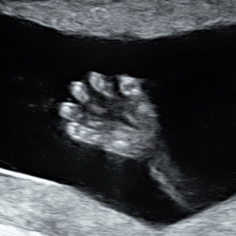 Scan Upon Request - at any time, even on short notice