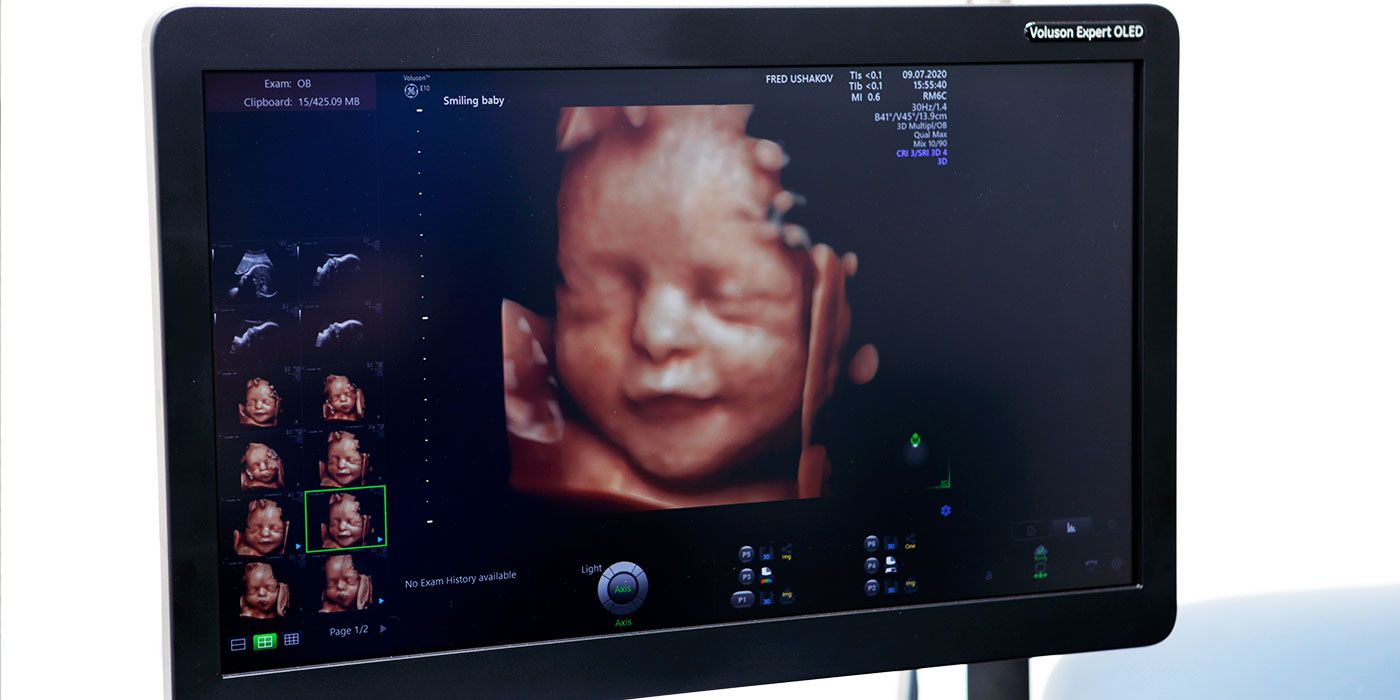 Third Trimester Anomaly Scan - The ultimate scan tracking your baby’s growth and development focusing on its developing brain.